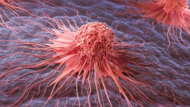 Molecule Discovered To Fuel Skin Cancer and Outsmart the Immune System