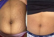 32 Products To Help Solve The Grooming Issues You Wish Would Disappear