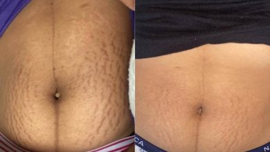 32 Products To Help Solve The Grooming Issues You Wish Would Disappear