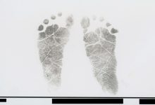 Tiny Footprints, a Blue Blanket: What I Can’t Forget About the Babies Who Died of Vitamin K Deficiency