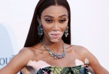 Vitiligo affects around 1 in 100 people worldwide – yet the skin condition remains misunderstood