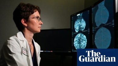 Groundbreaking genomic test could spare millions of breast cancer patients chemotherapy
