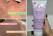 If You’ve Hit The “Body Acne” Part Of Your Skincare Journey, These 27 Products Can Help Combat It