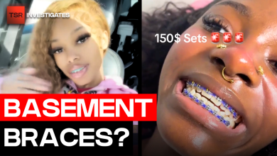 “Basement Braces” Are Going Viral And Dentists Are Concerned | TSR Investigates