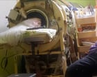 Martha Lillard, last known US polio survivor using iron lung, dies aged 78