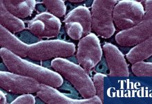 Louisiana warns beachgoers amid surge in flesh-eating bacteria infections