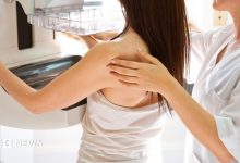 NHS trust to review 4,500 breast cancer cases after unnecessary surgeries found