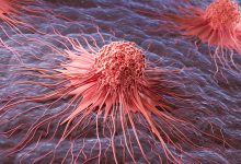 Molecule Discovered To Fuel Skin Cancer and Outsmart the Immune System